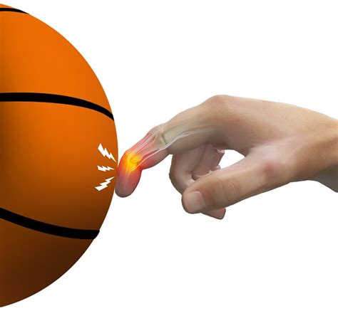 stubbed finger basketball